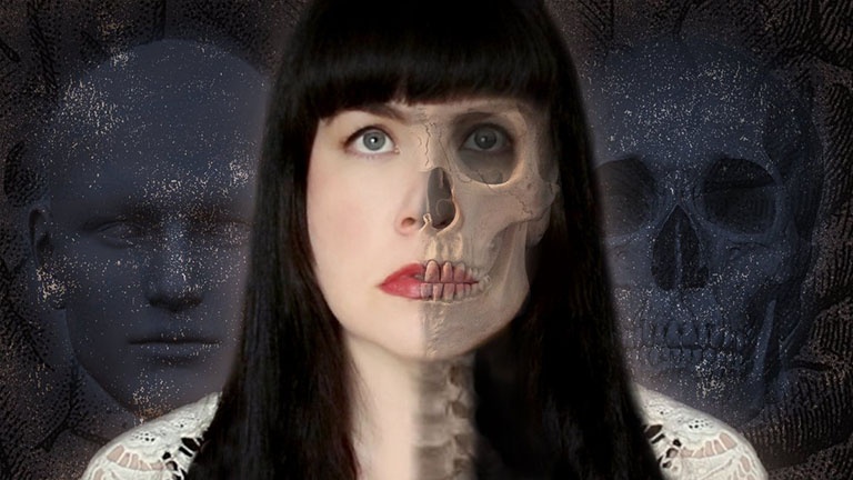 hội chứng xác sống